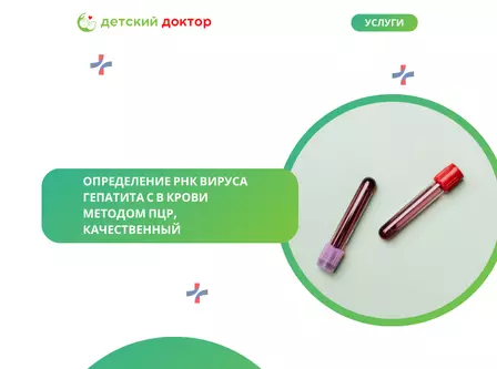 Определение РНК вируса гепатита С в крови методом ПЦР, количественный